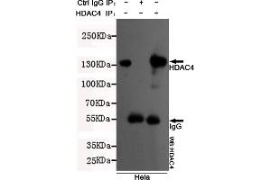 Immunoprecipitation analysis of Hela cell lysates using HDAC4 mouse mAb.