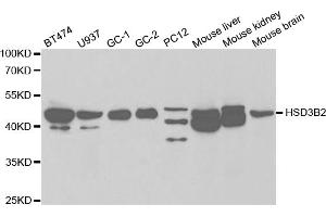 Western blot analysis of extracts of various cell lines, using HSD3B2 antibody (ABIN5970925) at 1/1000 dilution. (HSD3B2 anticorps)