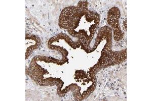 Immunohistochemical staining of human prostate with MIPOL1 polyclonal antibody  shows strong cytoplasmic positivity in glandular cells. (MIPOL1 anticorps)