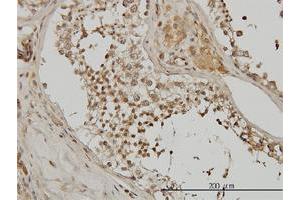 Immunoperoxidase of monoclonal antibody to ACTN4 on formalin-fixed paraffin-embedded human testis.