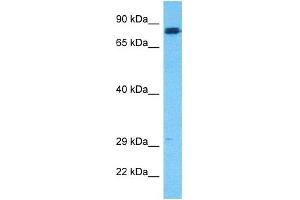 Host:  Rabbit  Target Name:  HGF  Sample Type:  721_B Whole Cell lysates  Antibody Dilution:  0.