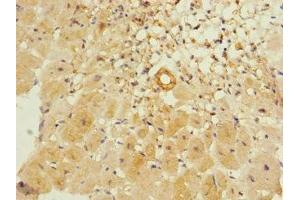 Immunohistochemistry of paraffin-embedded human heart tissue using ABIN7156429 at dilution of 1:100 (ITGA11 anticorps  (AA 940-1141))