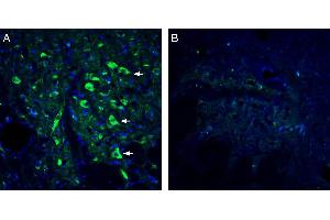 Expression of 5HT2A Receptor in rat dorsal raphe nucleus. (HTR2A anticorps  (Extracellular, N-Term))