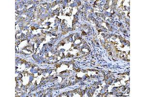 IHC analysis of CD147/Emmprin using anti-CD147/Emmprin antibody (ABIN7599999). (CD147 anticorps  (AA 138-323))