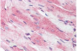 Mouse heart: Formalin-Fixed, Paraffin-Embedded (FFPE) (CD36 anticorps  (AA 99-114))