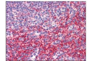 Human Spleen: Formalin-Fixed, Paraffin-Embedded (FFPE) (ATG9B anticorps  (C-Term))
