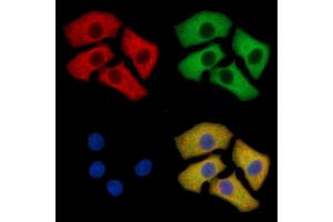 Grp75 Mouse Monoclonal Antibody staining HepG2 cells by IF/ICC. (HSPA9 anticorps  (C-Term))