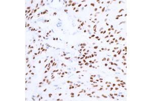 Immunohistochemistry (IHC) image for anti-SRY (Sex Determining Region Y)-Box 10 (SOX10) (AA 416-466) antibody (ABIN7454037)