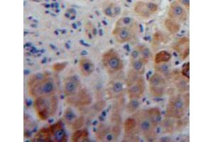 Used in DAB staining on fromalin fixed paraffin-embedded liver tissue (Aggrecan anticorps  (AA 34-147))