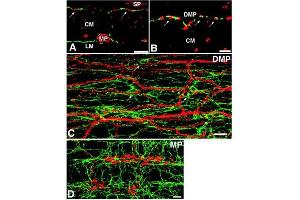 Double-labeling immunofluorescence for c-Kit and nitric oxide synthase (NOS) in the guinea-pig small intestine.