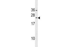 RAB5B antibody western blot analysis in HepG2 lysate.