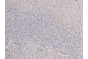 Immunohistochemistry (IHC) image for anti-Tubulin, beta 3 (TUBB3) antibody (ABIN1112834)