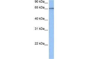 WB Suggested Anti-TAF15 Antibody Titration:  0. (TAF15 anticorps  (N-Term))