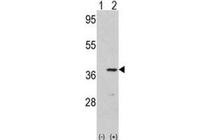 Western Blotting (WB) image for anti-Cyclin-Dependent Kinase 3 (CDK3) antibody (ABIN3003266)
