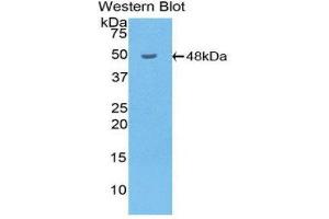 Western Blotting (WB) image for anti-Hyaluronidase-1 (HYAL1) (AA 52-462) antibody (ABIN1859237) (HYAL1 anticorps  (AA 52-462))