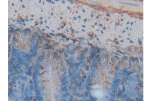 DAB staining on IHC-P; Samples: Mouse Intestine Tissue
