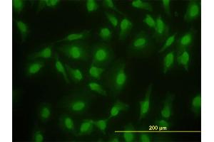 Immunofluorescence of monoclonal antibody to SMAD2 on HeLa cell.