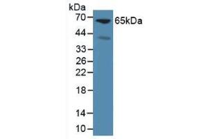 Western blot analysis of Mouse Liver Tissue. (Glypican 3 anticorps  (AA 344-559))