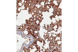 Immunohistochemical analysis of paraffin-embedded mouse lung tissue using (ABIN1539189 and ABIN2838276) performed on the Leica® BOND RXm. (TREM2 anticorps  (N-Term))