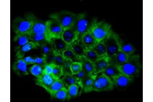 IF analysis of EPHB2 using anti-EPHB2 antibody (ABIN7601057).