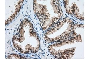Immunohistochemical staining of paraffin-embedded Human Kidney tissue using anti-USP5 mouse monoclonal antibody. (USP5 anticorps)