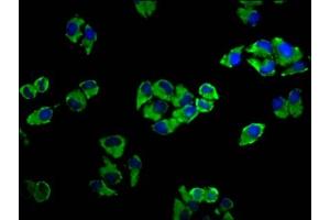 Immunofluorescence staining of Hela cells with ABIN7143330 at 1:33, counter-stained with DAPI. (ADCY5 anticorps  (AA 584-719))