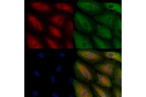 ABIN6261292 and ABIN6278563 staining  cells by IF/ICC. (HSD17B11 anticorps  (Internal Region))