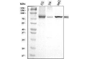 Western blot analysis of XPD/ERCC2 using anti-XPD/ERCC2 antibody (ABIN7602458).