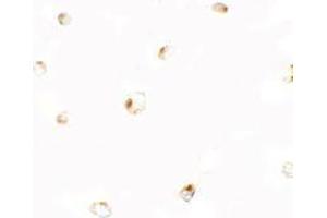 Immunocytochemistry of B9D1 in 293 cells with B9D1 antibody at 5 ug/mL.