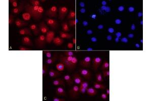 HepG2 cells probed with Rabbit Anti-HURP Polyclonal Antibody (ABIN713861) at 1:200 for overnight 4C followed by Goat Anti-Rabbit IgG, Cy3 conjugated for 40 minutes, at room temperature. (DLGAP5 anticorps  (AA 51-150))