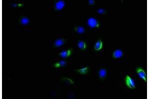 Immunofluorescence staining of A549 cells with ABIN7143175 at 1:166, counter-stained with DAPI.