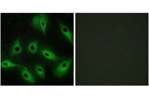 Immunofluorescence analysis of HeLa cells, using CDH9 Antibody. (Cadherin 9 anticorps  (AA 201-250))