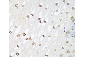 Immunohistochemistry of paraffin-embedded Human esophagus using FOSL2 Polyclonal Antibody at dilution of 1:100 (40x lens).