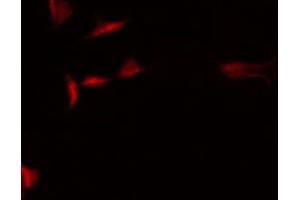 ABIN6266871 staining HepG2 by IF/ICC.