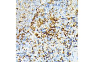 Immunohistochemistry of paraffin-embedded rat spleen using alpha 1 Spectrin antibody (ABIN6129333, ABIN6148401, ABIN6148402 and ABIN6215956) at dilution of 1:100 (40x lens).