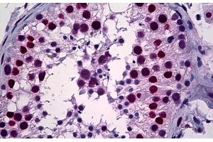 Human Testis: Formalin-Fixed, Paraffin-Embedded (FFPE) (YY1 anticorps  (AA 221-321))