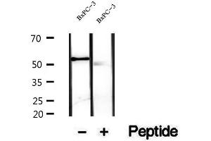 Western blot analysis of extracts of BxPC-3 cells, using VNN1 antibody.