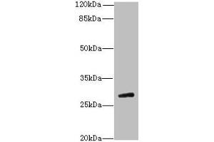 Western blot All lanes: TBC1D26 antibody at 3 μg/mL + Mouse liver tissue Secondary Goat polyclonal to rabbit IgG at 1/10000 dilution Predicted band size: 29, 25, 10 kDa Observed band size: 29 kDa (TBC1D26 anticorps  (AA 1-250))