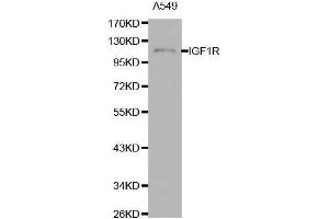 Western blot analysis of extracts of A549 cells using IGF1R antibody. (IGF1R anticorps  (AA 660-760))