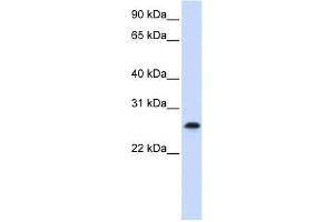 PHF19 antibody used at 0. (PHF19 anticorps  (C-Term))