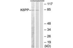 Western Blotting (WB) image for anti-phosphofructokinase, Platelet (PFKP) (AA 341-390) antibody (ABIN2889539) (PFKP anticorps  (AA 341-390))