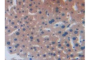 Detection of AGRP in Mouse Liver Tissue using Polyclonal Antibody to Agouti Related Protein (AGRP)