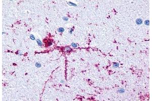 Anti-GRM8 / MGLUR8 antibody  ABIN1048945 IHC staining of human brain, neurons and glia. (GRM8 anticorps  (N-Term))
