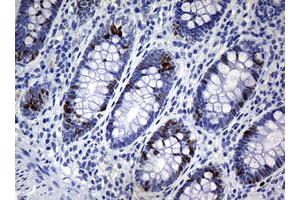 Image no. 4 for anti-Antigen Identified By Monoclonal Antibody Ki-67 (MKI67) (AA 1160-1493) antibody (ABIN1490857) (Ki-67 anticorps  (AA 1160-1493))