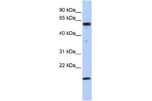 Human Jurkat; WB Suggested Anti-TRIP10 Antibody Titration: 0. (TRIP10 anticorps  (Middle Region))