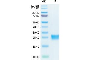 Biotinylated Human IL-17F on Tris-Bis PAGE under reduced condition.