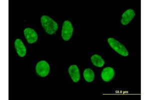 Immunofluorescence of monoclonal antibody to FBXO11 on HeLa cell.