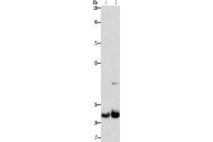 Gel: 8 % SDS-PAGE, Lysate: 40 μg, Lane 1-2: Lovo cells, PC3 cells, Primary antibody: ABIN7130253(MPG Antibody) at dilution 1/950, Secondary antibody: Goat anti rabbit IgG at 1/8000 dilution, Exposure time: 1 minute (MPG anticorps)