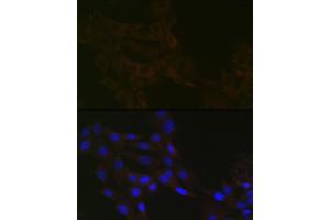 Immunofluorescence analysis of NIH-3T3 cells using γ-Tubulin Rabbit mAb (ABIN7271052) at dilution of 1:100 (40x lens).