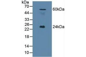 Detection of EFNA1 in Mouse Testis Tissue using Polyclonal Antibody to Ephrin A1 (EFNA1)